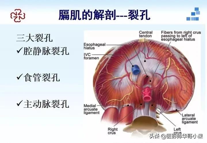 「精品课件」胸部膈肌的解剖及常见病变影像的表现
