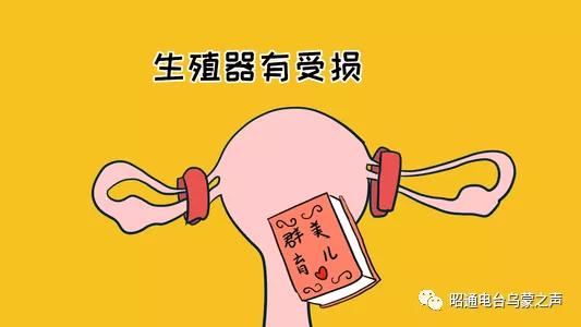 助您好“孕”《祝您健康》昭通仁安医院彭艺医生教你备孕知识