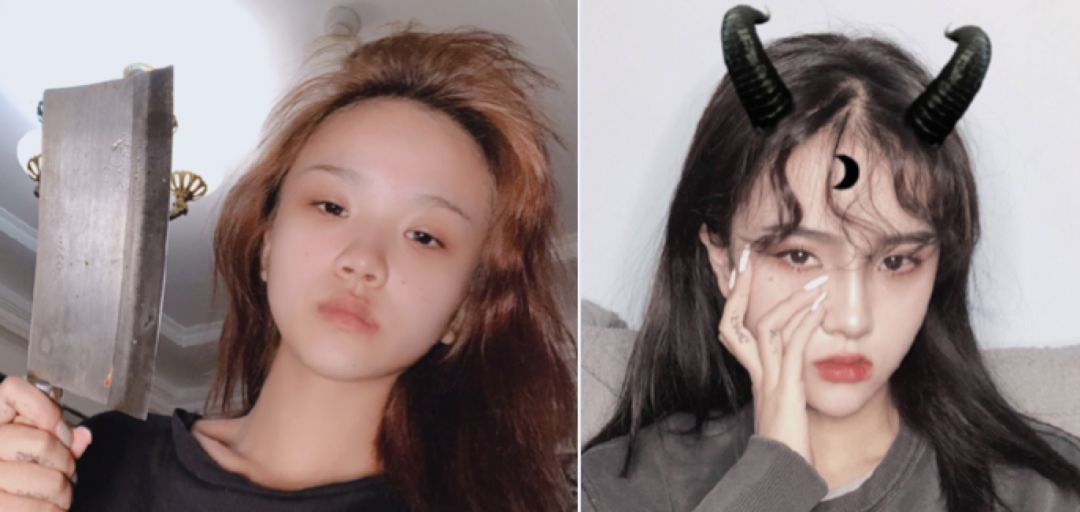 网红抽脂去世真的是意外,网红去抽脂