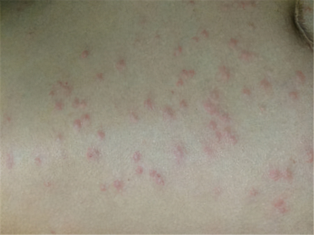 冠脉ct和冠脉造影的间隔时间多长,冠脉造影ct是怎么检查的