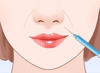 打瘦脸针3次真的可以永久定型吗,瘦脸针打三次真的能定型么