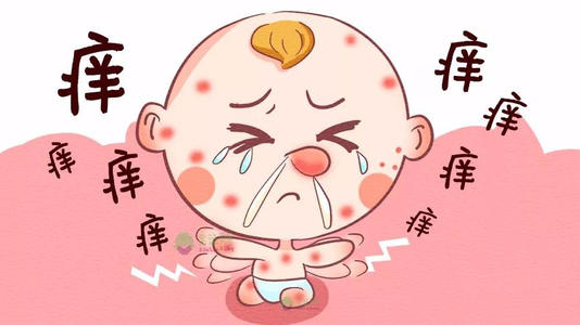 你家宝宝过敏了吗,宝宝是过敏体质怎么护肤