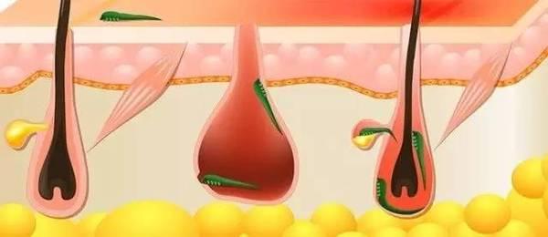 犬蠕形螨怎么治疗,犬蠕形螨和疥螨的区别