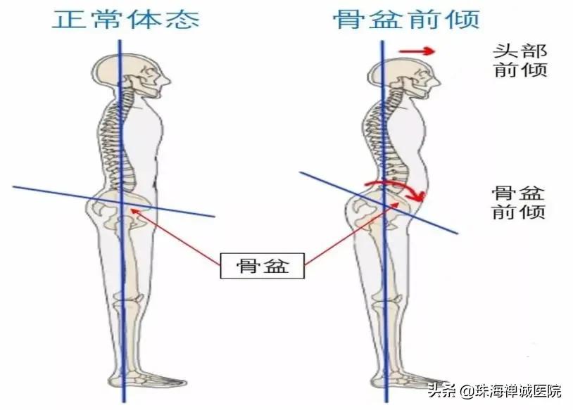 是否要做产后治疗,要不要做产后修复