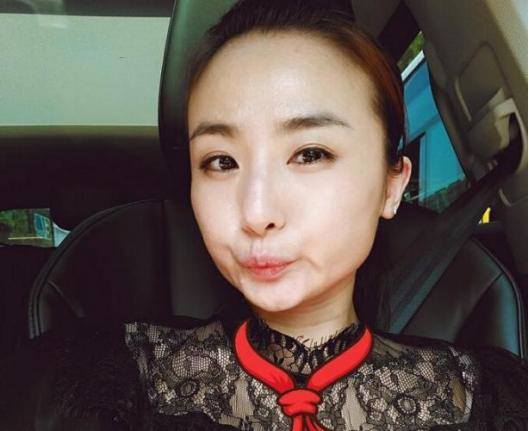 体坛冠军退役后遗症,体坛名将因伤退役都有谁