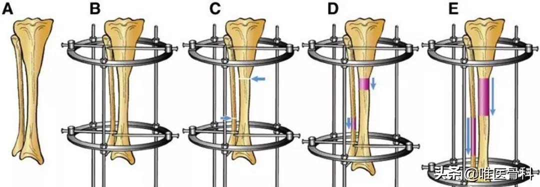 长腿秘诀大全图解,原来大长腿是这样炼成的
