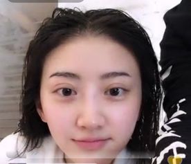 双眼皮不要盲目跟风,别割双眼皮