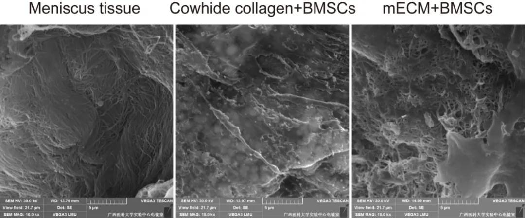 深圳先进院研发可注射活体生物材料修复半月板损伤并抑制关节退变
