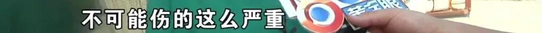 钢化玻璃爆裂会不会伤到人,钢化玻璃爆裂有碎渣掉落吗