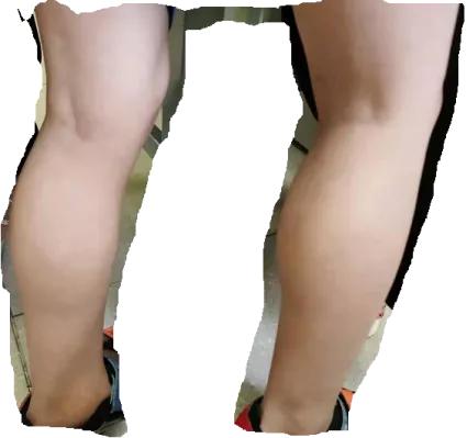 肝病转氨酶升高一般吃什么中药,转氨酶高是肝病吗