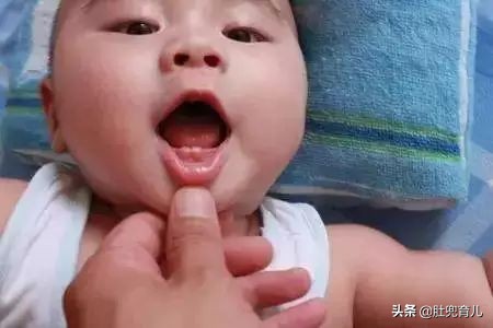 宝宝得了口水疹,宝宝得了口水疹怎么治疗