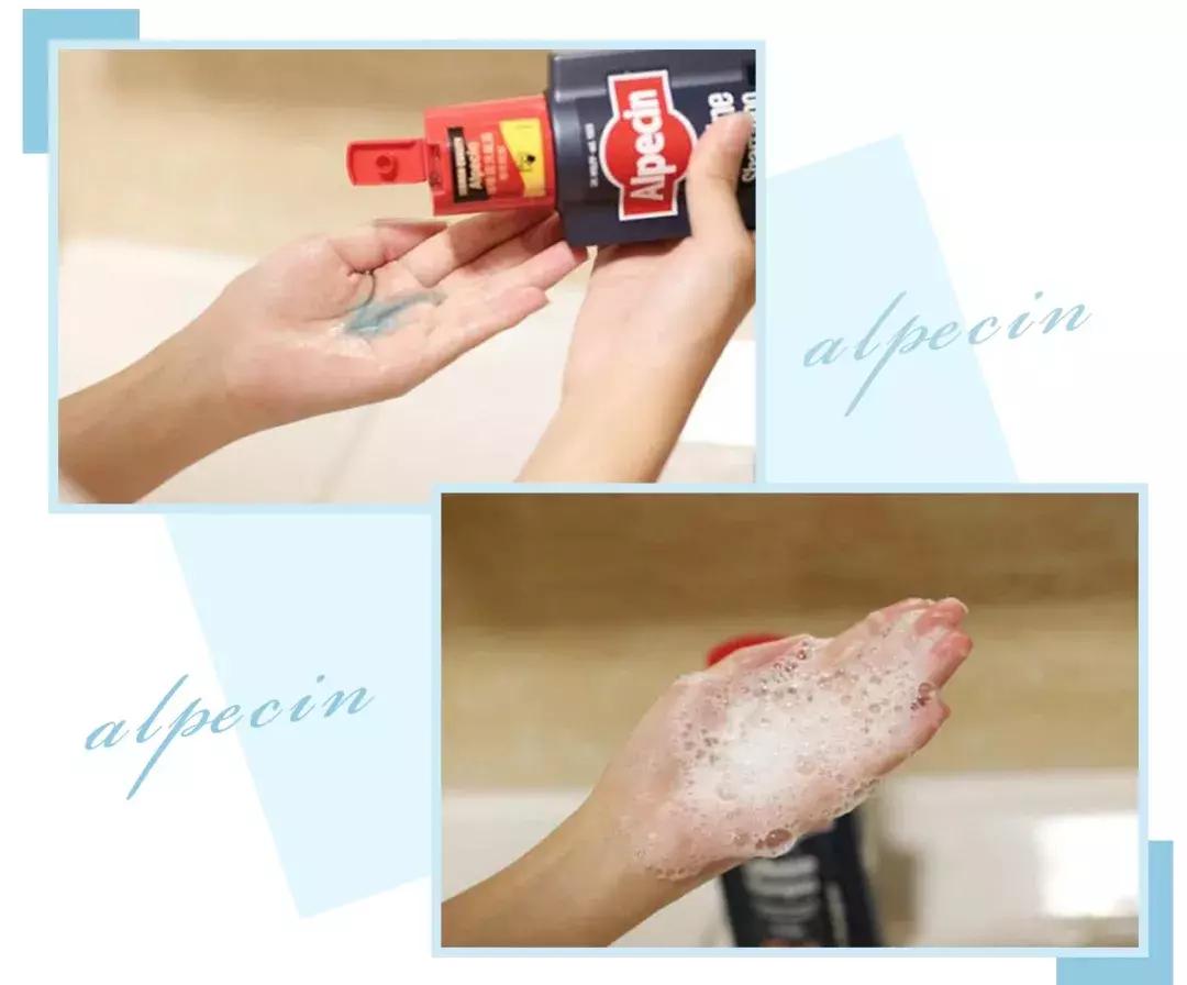 赵丽颖秃头照,赵丽颖秃顶原因