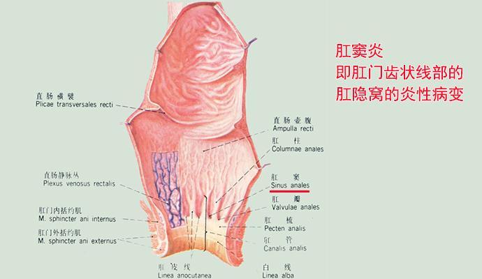 大便粘马桶肛门潮湿有分泌物,肛门周围有小颗粒潮湿痒分泌物