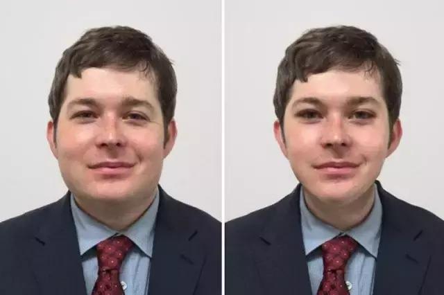 韩国小伙整容成功案例,外国男子整容成韩国人