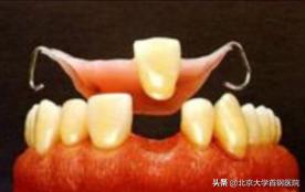 牙列缺损与牙体缺损,牙体缺失和牙列缺损区别