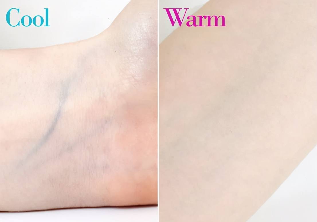 皮肤黑穿搭有什么雷区,皮肤黑穿什么颜色显白平价