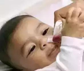 20天婴儿感冒咳嗽鼻塞严重怎么办,0-1岁婴儿感冒流鼻涕鼻塞怎么处理