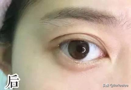 防眼角皱纹最好的方法,眼部皱纹多特别显老