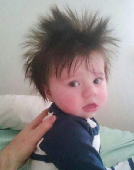 小孩头发像刺猬一样什么原因,小宝宝头发一绺一绺的是怎么回事