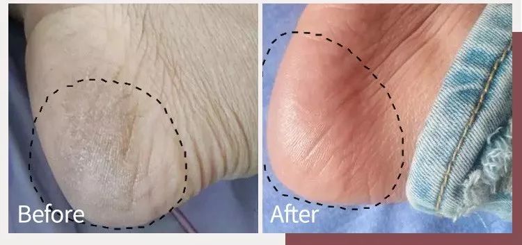 蔡依林皮肤特护霜,蔡依林胶原蛋白粉保养皮肤