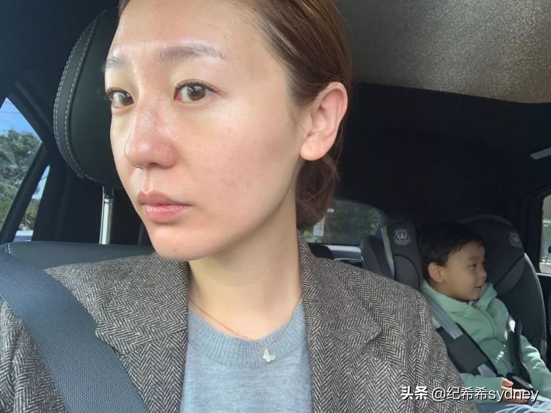 蜂巢皮秒祛斑一到七天变化图,蜂巢皮秒效果多久出来