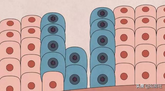 羞羞后警惕HPV感染,一不小心会得宫颈癌