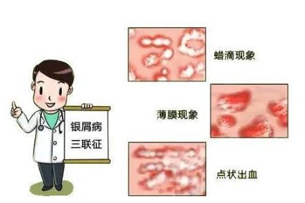 10岁孩子浑身起红点,10岁孩子身上起红点怎么回事