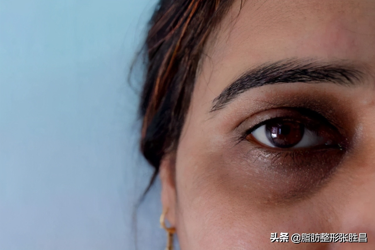 失眠黑眼圈重喝什么比较好,失眠黑眼圈怎么快速消除