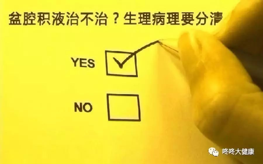 盆腔积液是不是就是盆腔炎,盆腔积液是妇科上的疾病吗