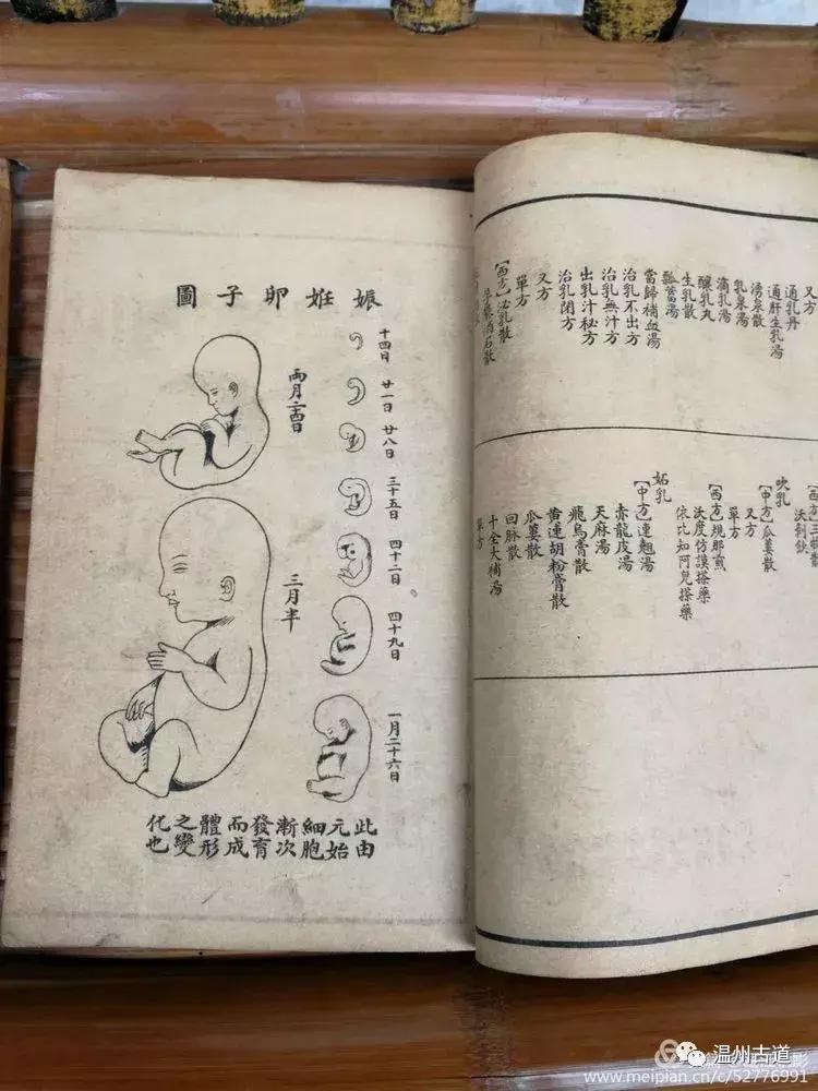 温州瞿溪老照片,温州瞿溪老街历史