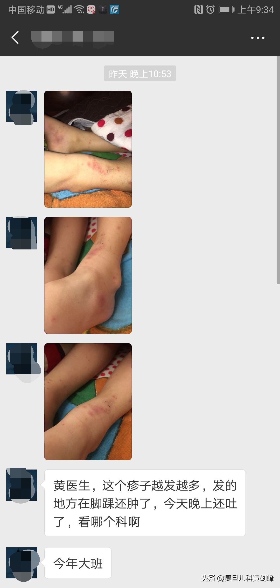 孩子腿上都是湿疹,宝宝腿上大面积皮疹