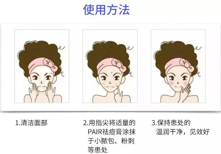 狮王祛痘膏和过氧苯甲酰凝胶,日本狮王祛痘膏可以长期使用吗