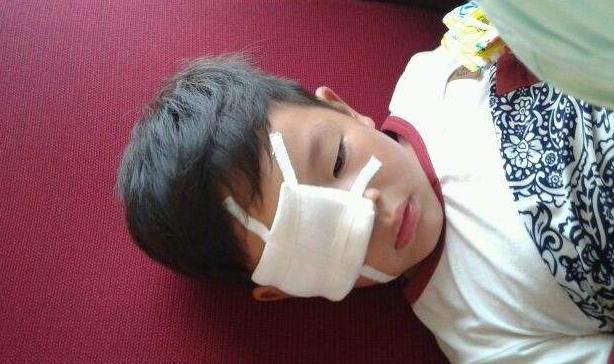 小孩石灰进眼睛,小孩眼睛迷了东西