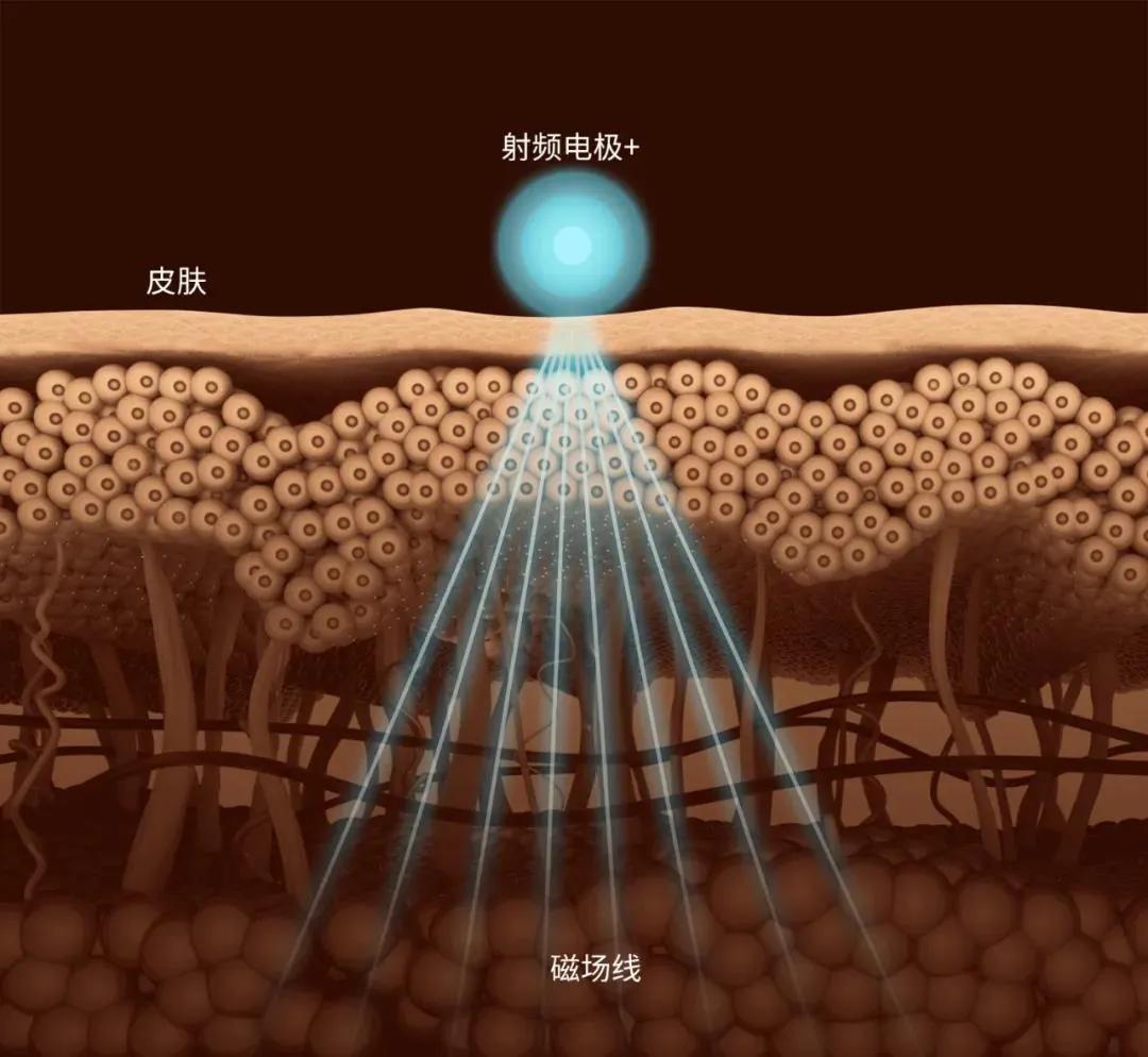 美容仪,可以对抗岁月痕迹?