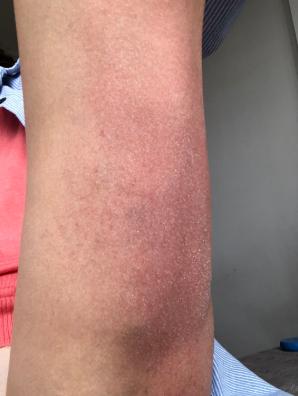 拍打膀胱有什么好处,拍打膀胱有助排尿吗