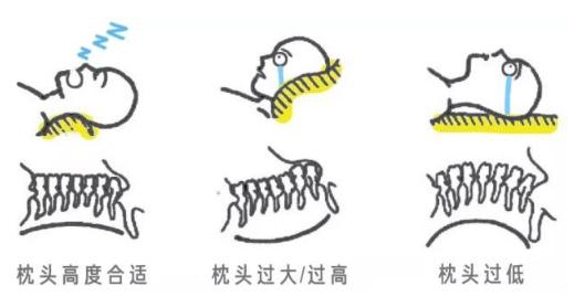 乳胶枕对颈椎有用吗,乳胶枕越睡脖子越痛