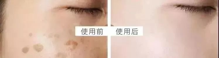 东星祛斑霜为什么火了,东星祛斑霜是真的吗