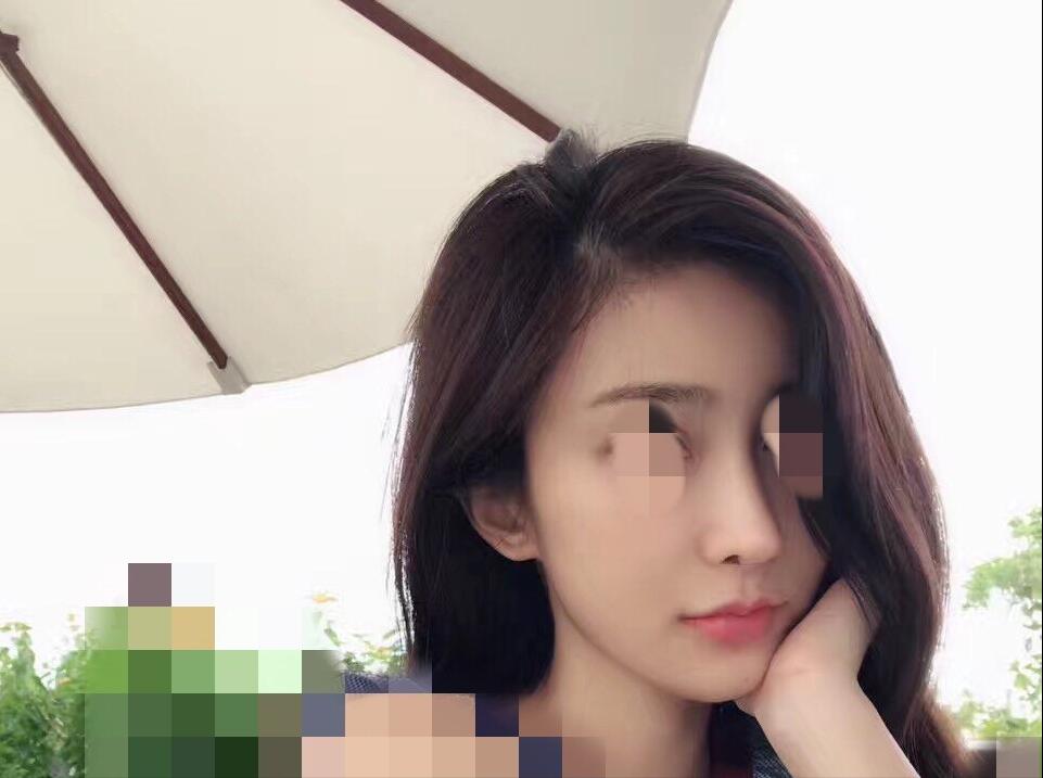 鼻头高度不够怎么办,我的鼻头老是红的怎么办