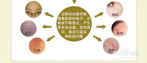 美白淡斑抗衰老的神器,抗老抗皱抗氧化