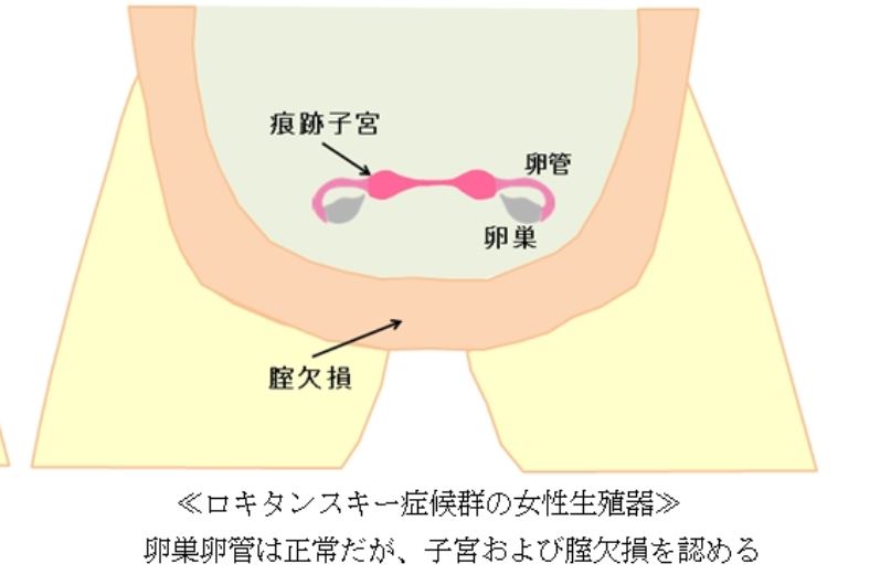 结婚四年的日本夫妇，妻子隐瞒自己没有子宫！坦白后丈夫如此反应