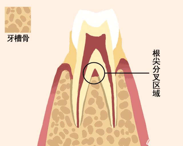 牙齿松动感觉要掉了还能怎么拯救,牙齿松动最佳补救要花多少钱