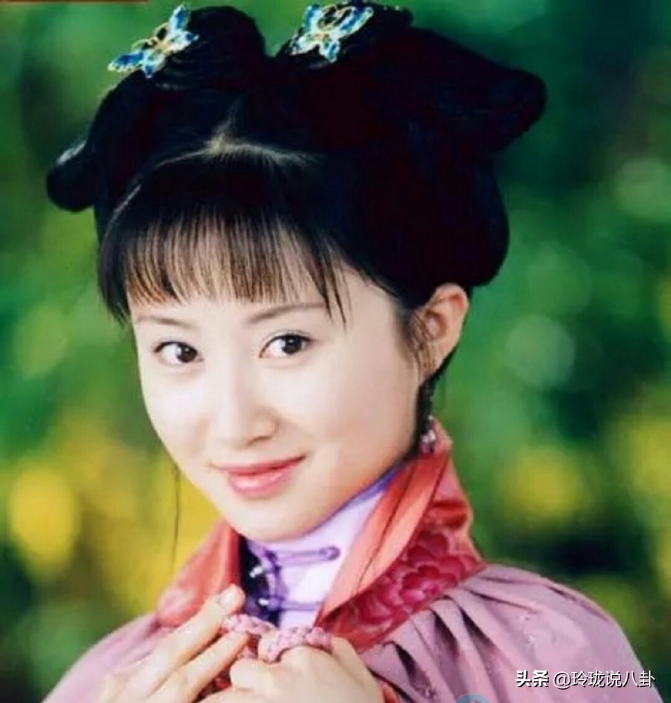 有哪些明星过度整容惨不忍睹,整容失败女明星今昔对比