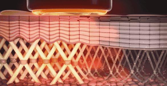 热玛吉今年降价了么,热玛吉未来会降价吗