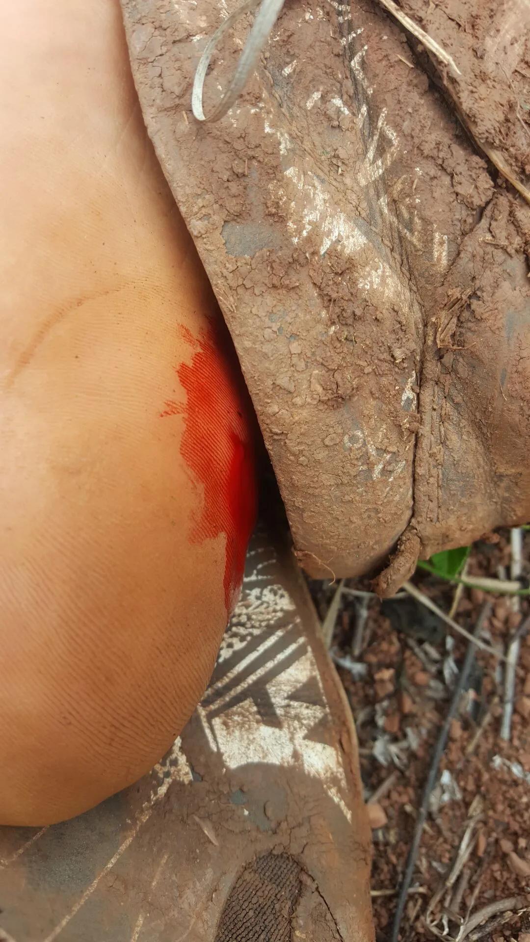 鸡枞菌菇,野生鸡枞