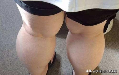 怎样瘦小腿训练,瘦小腿内侧腓肠肌练习