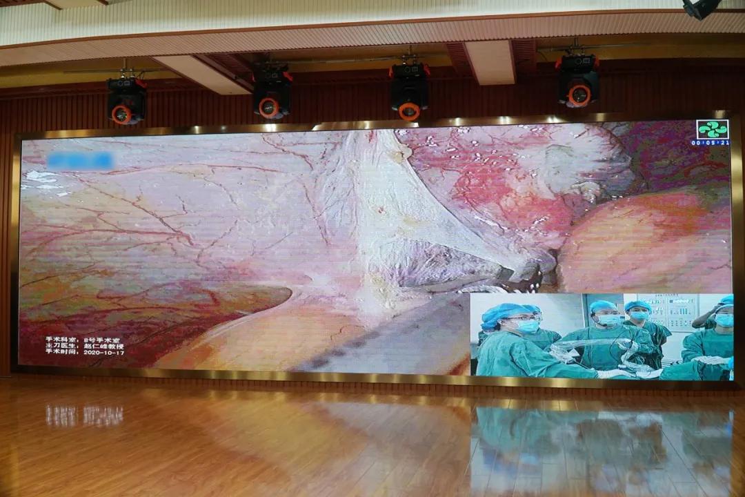 桂林妇幼医院免费宫颈癌筛查,桂林宫颈癌筛查