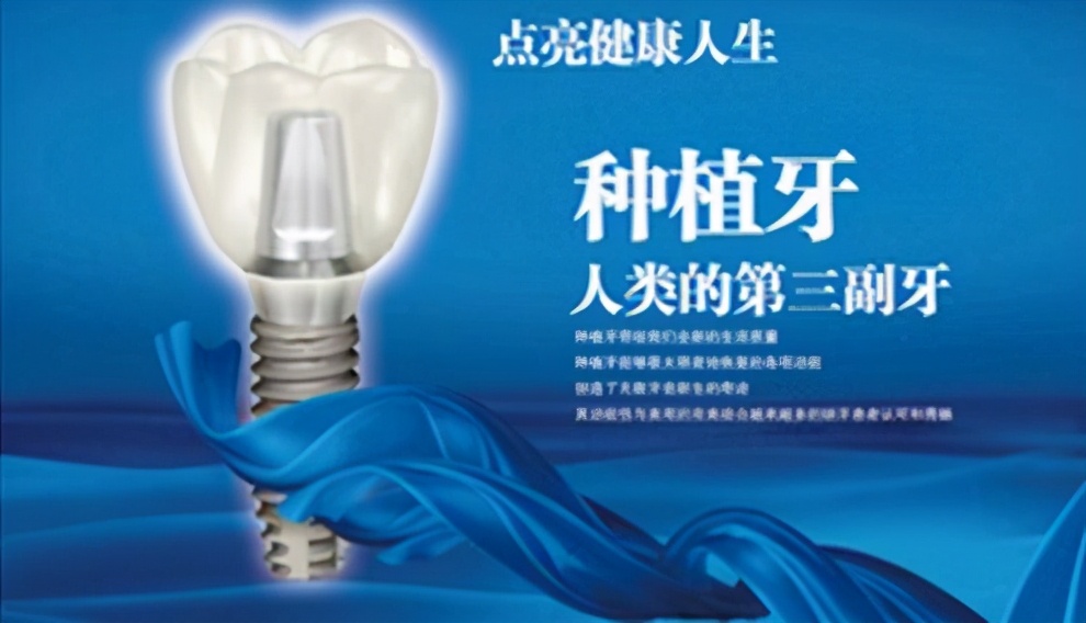 两千块种牙,上海雅悦齿科