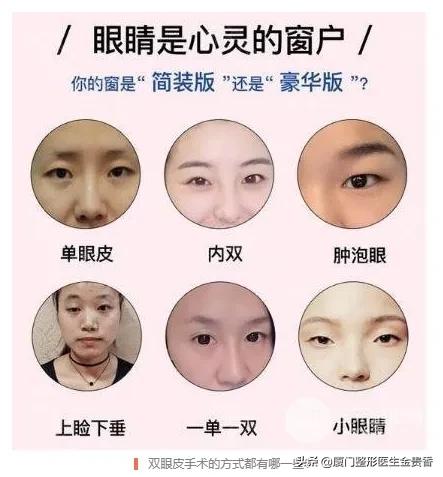 纳米无痕埋线双眼皮需不需要拆线,纳米无痕双眼皮动画操作过程视频