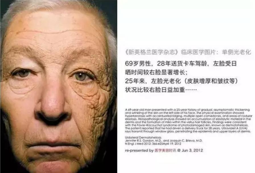 防晒装备真的有效么,防晒装备品牌