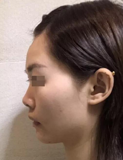 韦敏做鼻子怎么样,韦敏鼻子